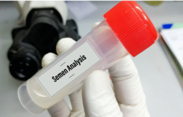 Infertility Assessment Test (MALE)