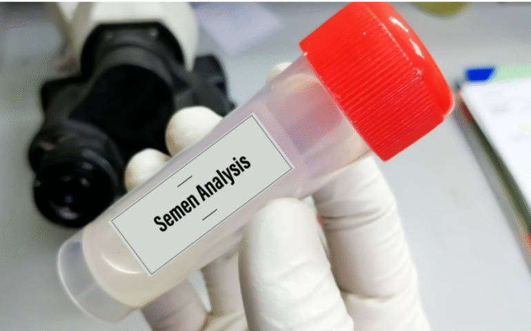 Infertility Assessment Test (MALE)